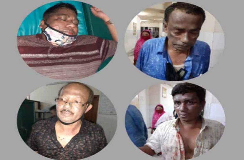 চট্টগ্রামে গ্যাস লাইট বিস্ফোরণে দ্বগ্ধ ৫